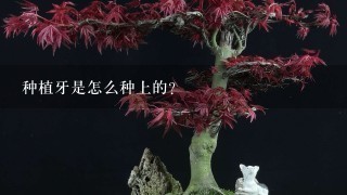 种植牙是怎么种上的？