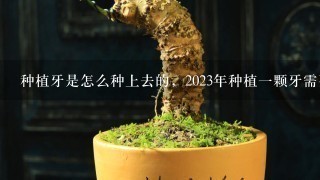 种植牙是怎么种上去的，2023年种植1颗牙需要多少钱